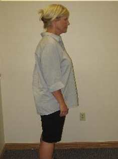 Holly has been able to maintain her weight after finding a solution with Advanced Medical Weight Loss.